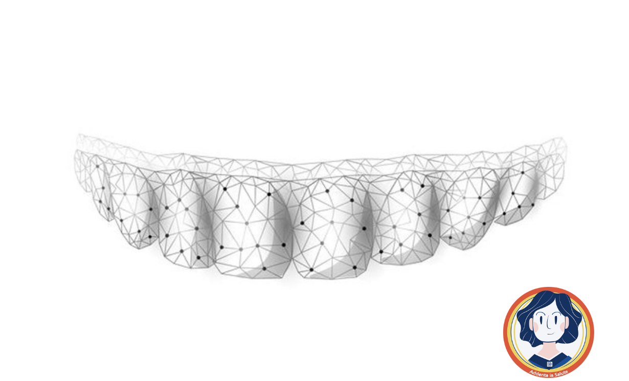 Gli allineatori dentali